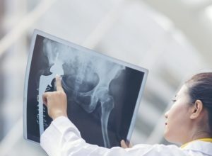 “他的癌症很凶猛” 大马女星爆丈夫癌细胞扩散