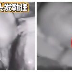脖子被头发越缠越紧 男童险在睡梦中断气