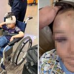 疑遭机场电动车撞倒 男童眼眶骨折兼脑震荡