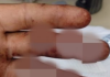 商讨拖欠工资变冲突 男子持刀砍伤3人