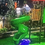 女童遭男童推下滑梯 眼眶骨折头部有血肿