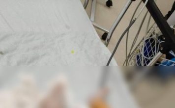 2个月大男婴疑遭保姆伤害 脑出血送PICU