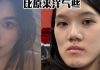 做正颚手术后脸歪毁容 女子公布“变形照”控诉医生
