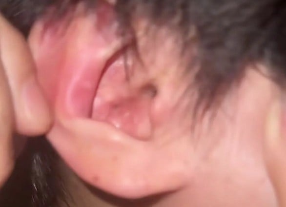 fn260612ear02