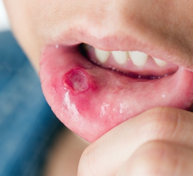 mouth