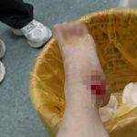 情侣火锅店热吻酿意外 撞翻火锅烫伤邻桌女客