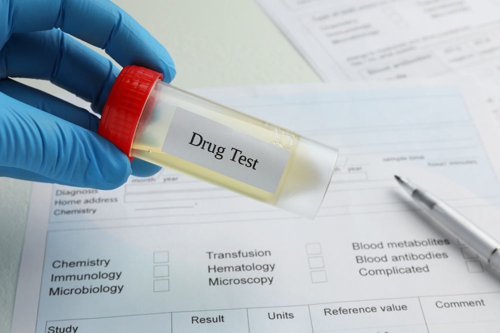 Drug,Test.,Laboratory,Worker,Holding,Container,With,Urine,Sample,Over
