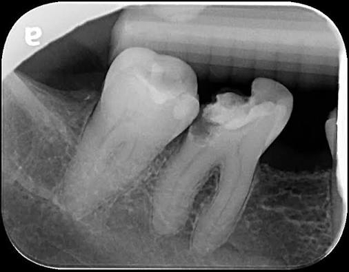 teeth