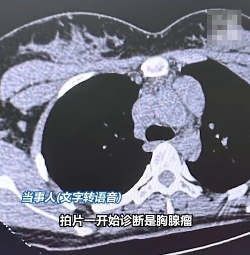 01KZQQ8YC8545AQ5YJHC3PKJF1