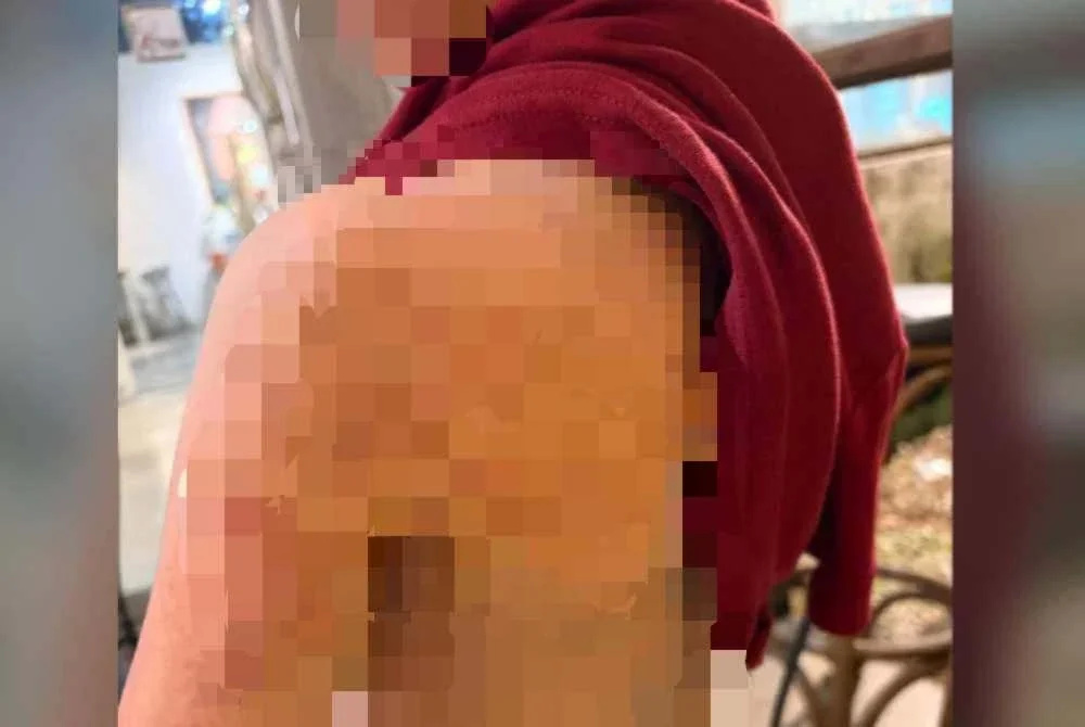 3647128