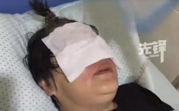 外孙把打火机丢入煮沸热水 外婆取出瞬间爆炸脸部烫伤