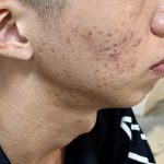 免费测脸变花逾1万 华裔母亲揭儿美容花费惊人
