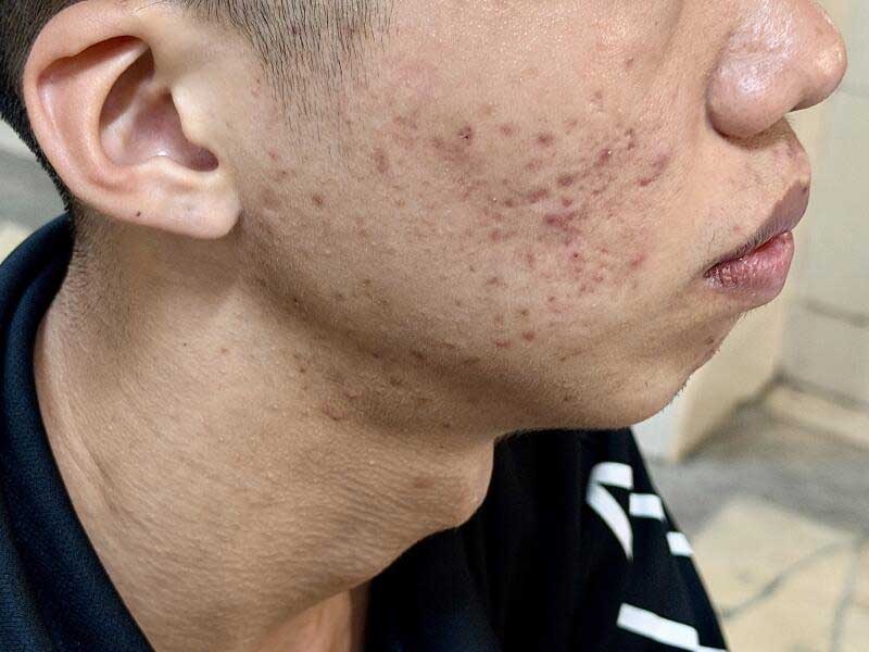 20261011CPKK35c_SINGAPORE_FACIAL