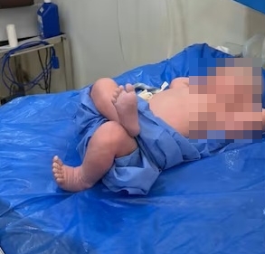 BAYI