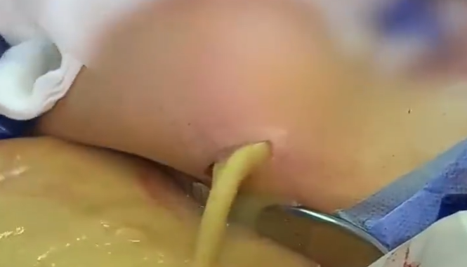 susu